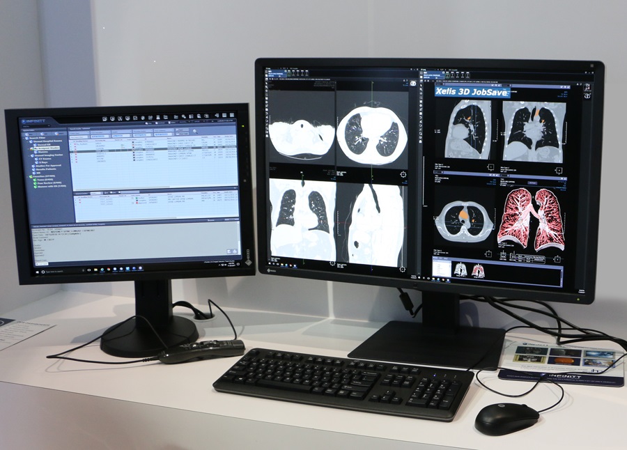 INFINITT PACS Ranked 1 PACS Community And 1 PACS Imaging Centers INFINITT PACS Ranked 1 PACS Community And 1 PACS Imaging Centers